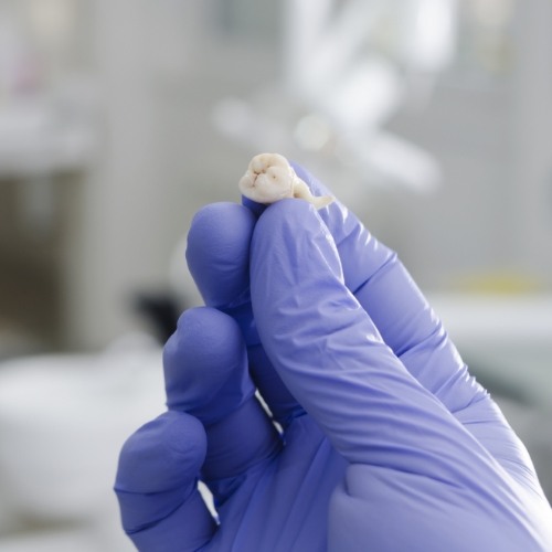 Gloved hand holding an extracted tooth