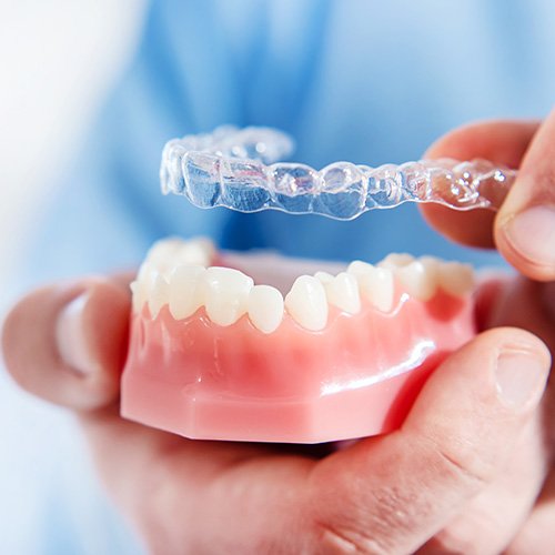 Dentist holding Invisalign aligner over a mouth mold