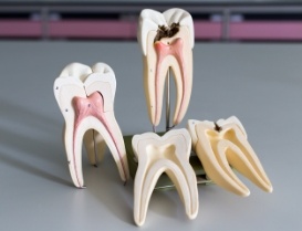 Several models of damaged teeth on desk